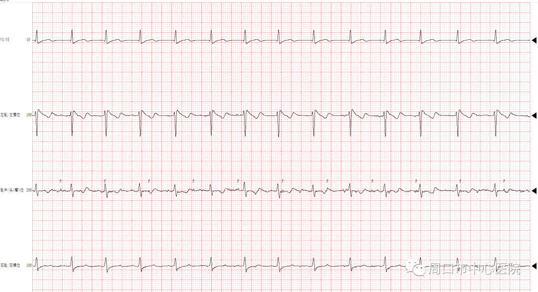 胎儿心电图是什么意思医疗科普_https://www.jmylbn.com_新闻资讯_第2张