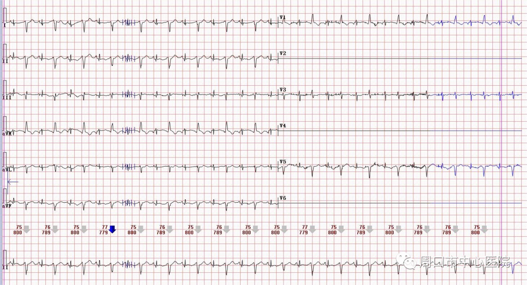胎儿心电图是什么意思医疗科普_https://www.jmylbn.com_新闻资讯_第3张