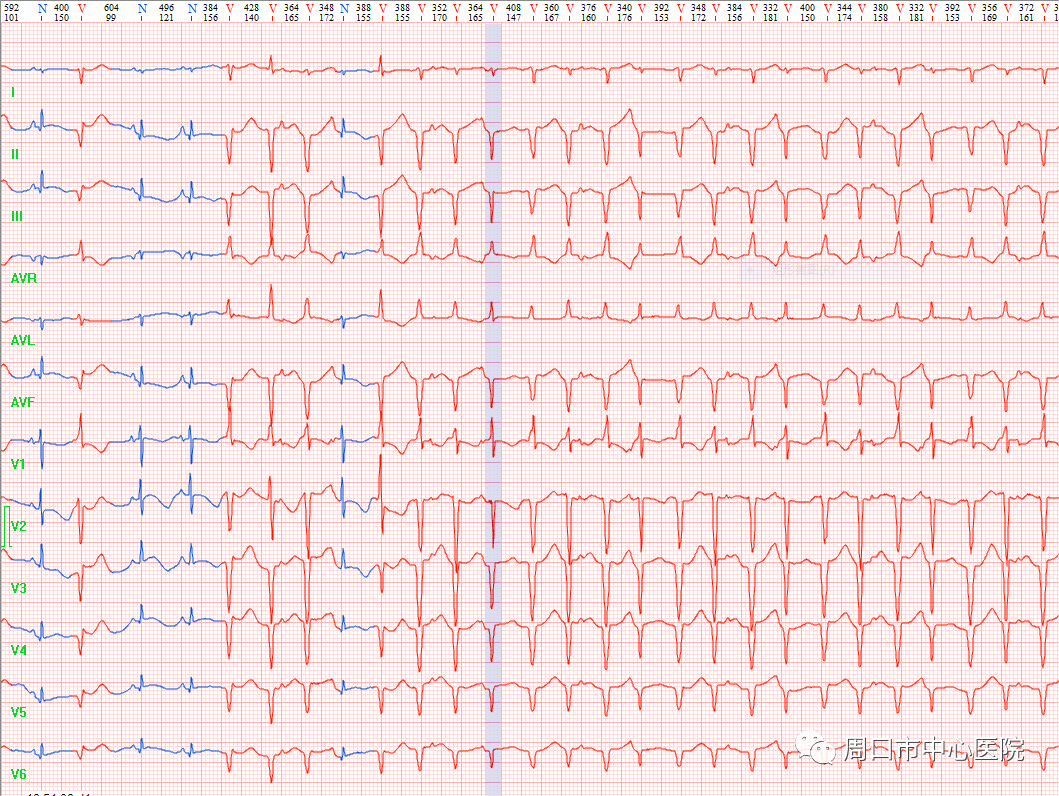 胎儿心电图是什么意思医疗科普_https://www.jmylbn.com_新闻资讯_第4张