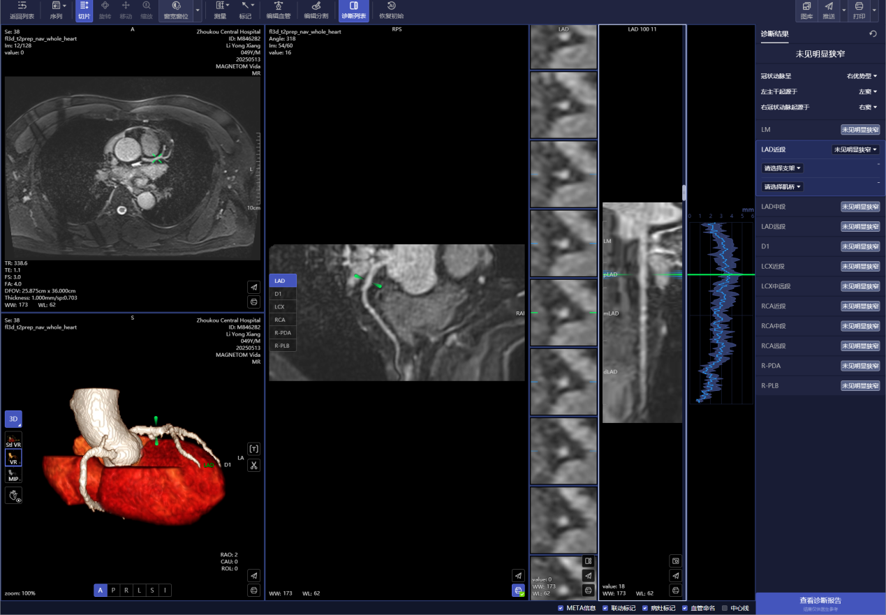 1607114542517472.png c1db468a82fc89dc4a3ce86854ae0a7.png